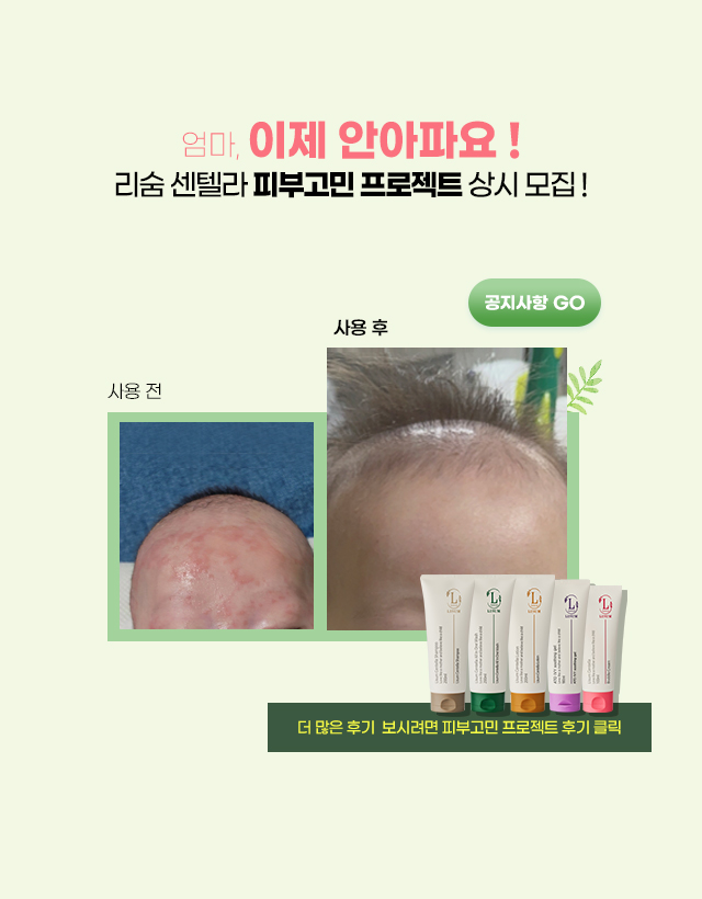 피부고민 프로젝트 참여하러가기